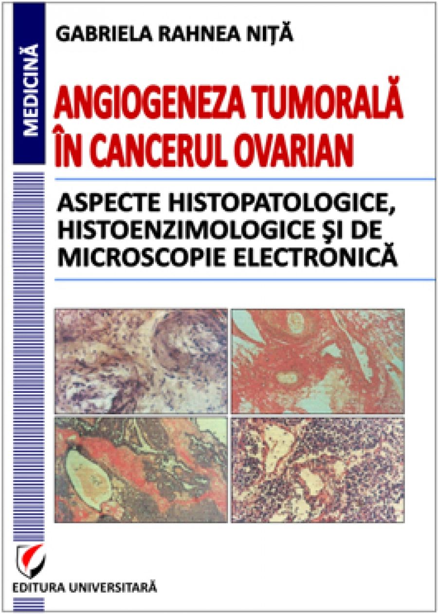 Angiogeneza tumorala in cancerul ovarian. Aspecte histopatologice, histoenzimologice si de microscopie electronica